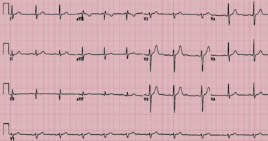 This Startup Can Detect a Dangerous Blood Condition Through Heart Signals This Startup Can Detect a Dangerous Blood Condition Through Heart Signals