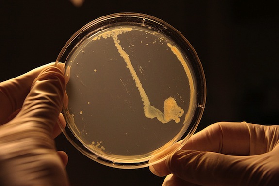 Could This Superbug Take Us All Out?