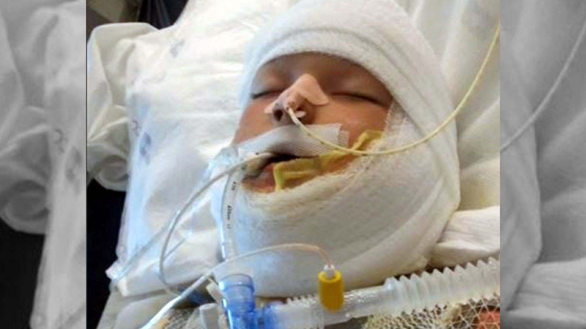 10-year Old Deaf Boy Set On Fire