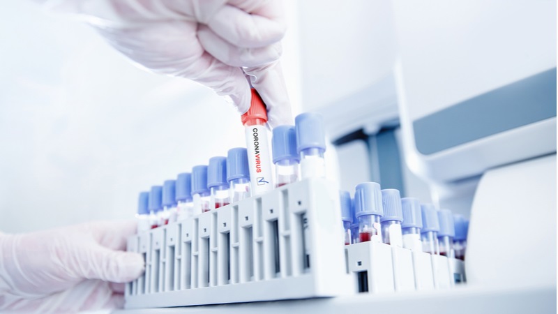 Oncocyte Shares Explode on Licensing Deal with China’s Burning Rock Biotech