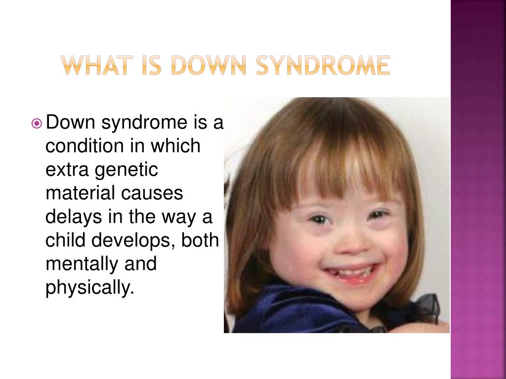 This image has an empty alt attribute; its file name is what-is-down-syndrome-l.jpg